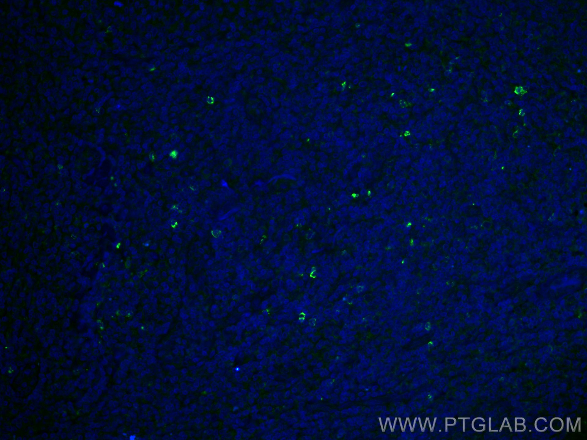 Immunofluorescence (IF) / fluorescent staining of human tonsillitis tissue using LAG-3 Polyclonal antibody (16616-1-AP)