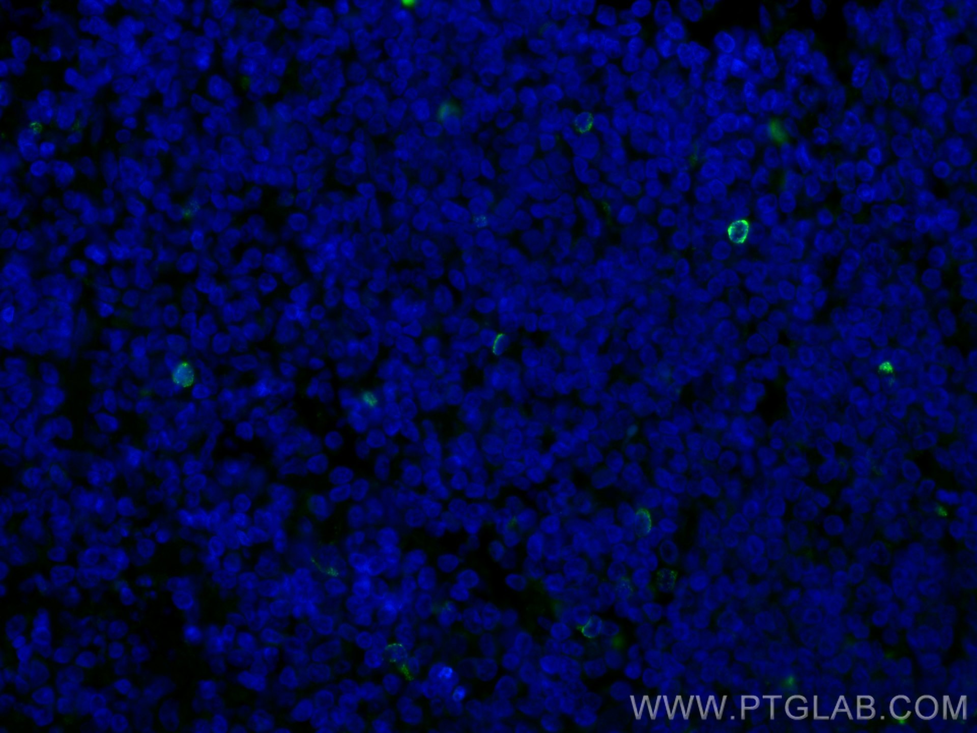 Immunofluorescence (IF) / fluorescent staining of human tonsillitis tissue using LAG-3 Polyclonal antibody (16616-1-AP)