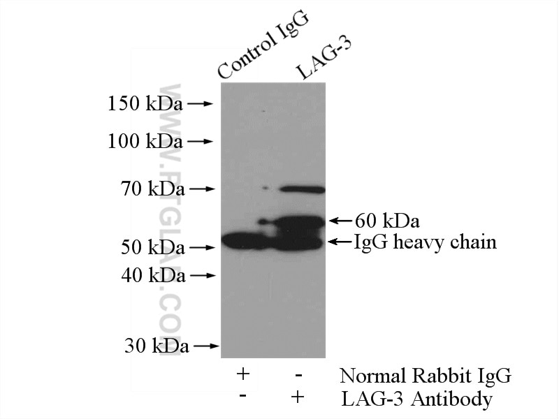 Immunoprecipitation (IP) experiment of mouse liver tissue using LAG-3 Polyclonal antibody (16616-1-AP)