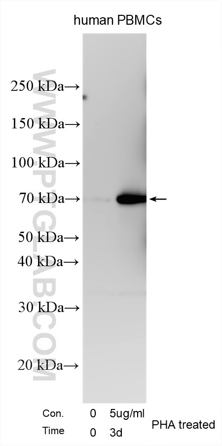 Western Blot (WB) analysis of various lysates using LAG-3/CD223 Polyclonal antibody (16616-1-AP)