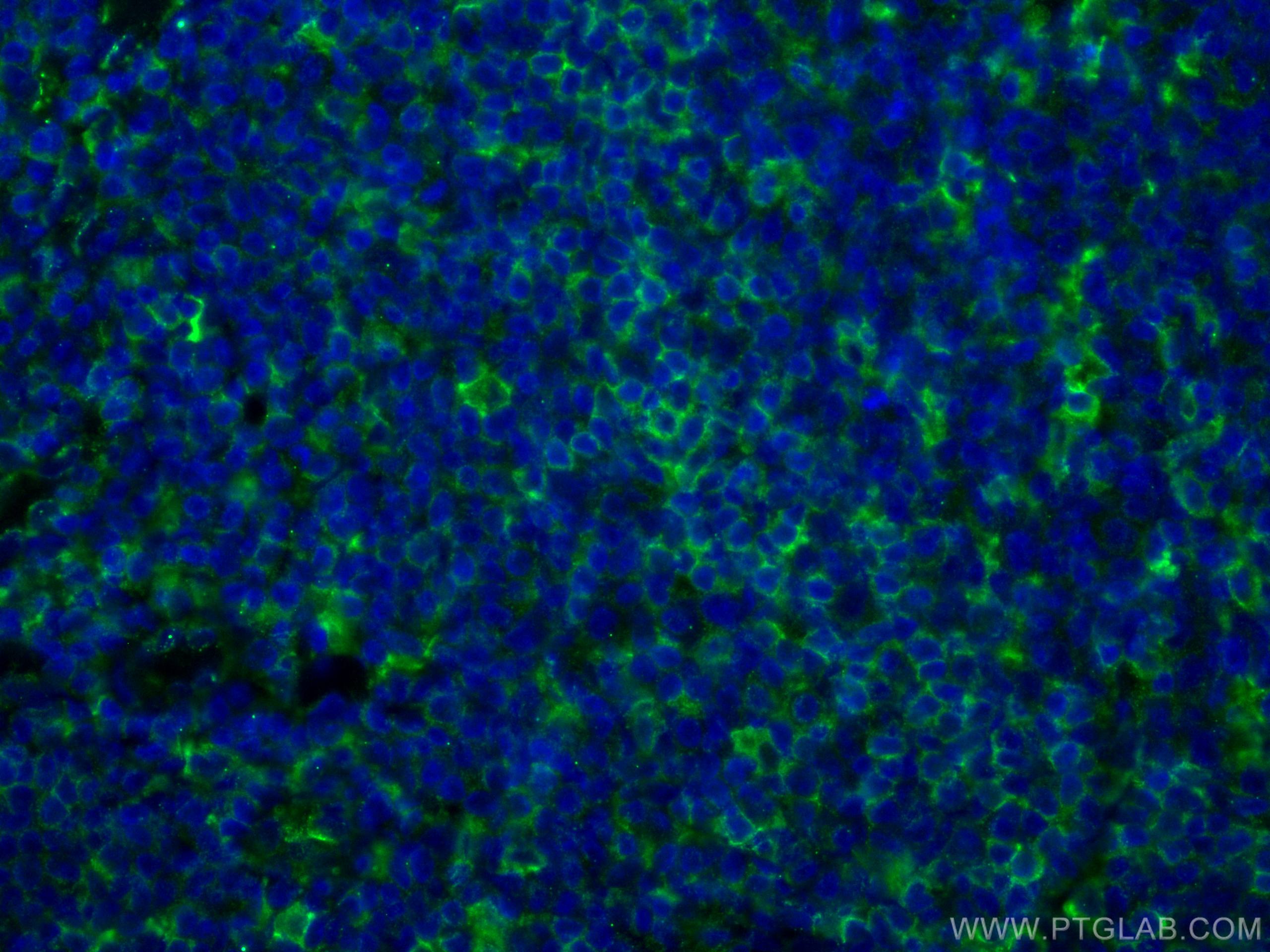 Immunofluorescence (IF) / fluorescent staining of human tonsillitis tissue using LAIR1 Monoclonal antibody (67220-1-Ig)