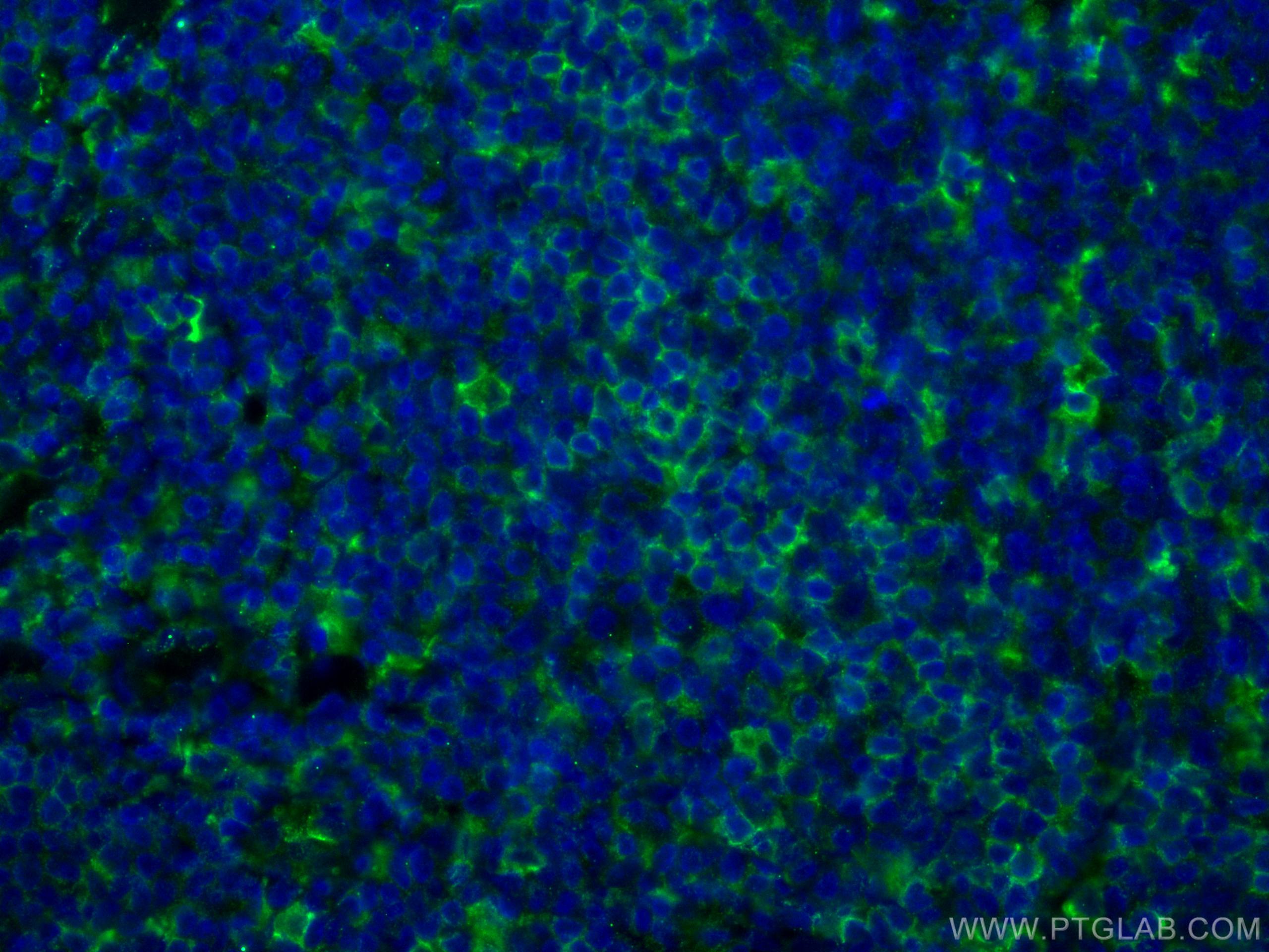 Immunofluorescence (IF) / fluorescent staining of human tonsillitis tissue using LAIR1 Monoclonal antibody (67220-1-Ig)