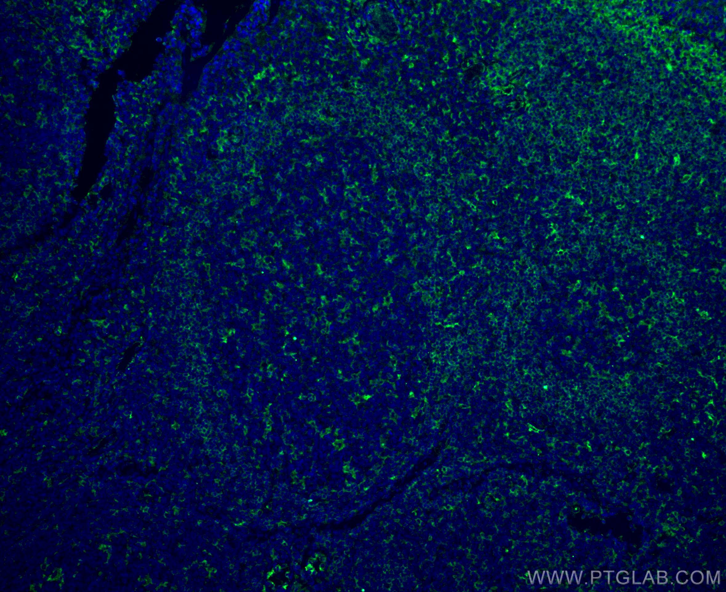 Immunofluorescence (IF) / fluorescent staining of human tonsillitis tissue using LAIR1 Monoclonal antibody (67220-1-Ig)