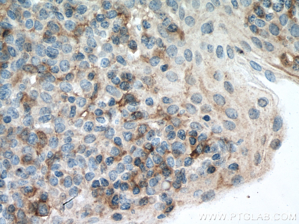 Immunohistochemistry (IHC) staining of human tonsillitis tissue using LAIR1 Monoclonal antibody (67220-1-Ig)