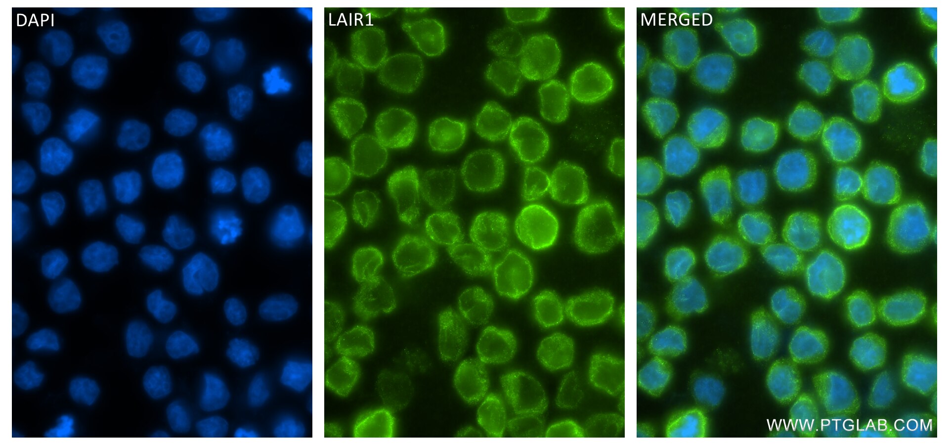 Immunofluorescence (IF) / fluorescent staining of THP-1 cells using LAIR1 Recombinant antibody (84677-4-RR)