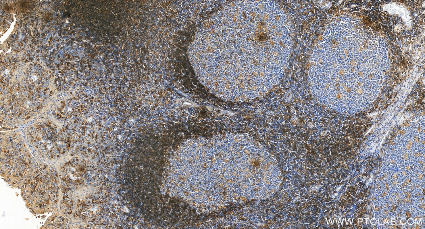 Immunohistochemistry (IHC) staining of human tonsillitis tissue using LAIR1 Recombinant antibody (84677-4-RR)