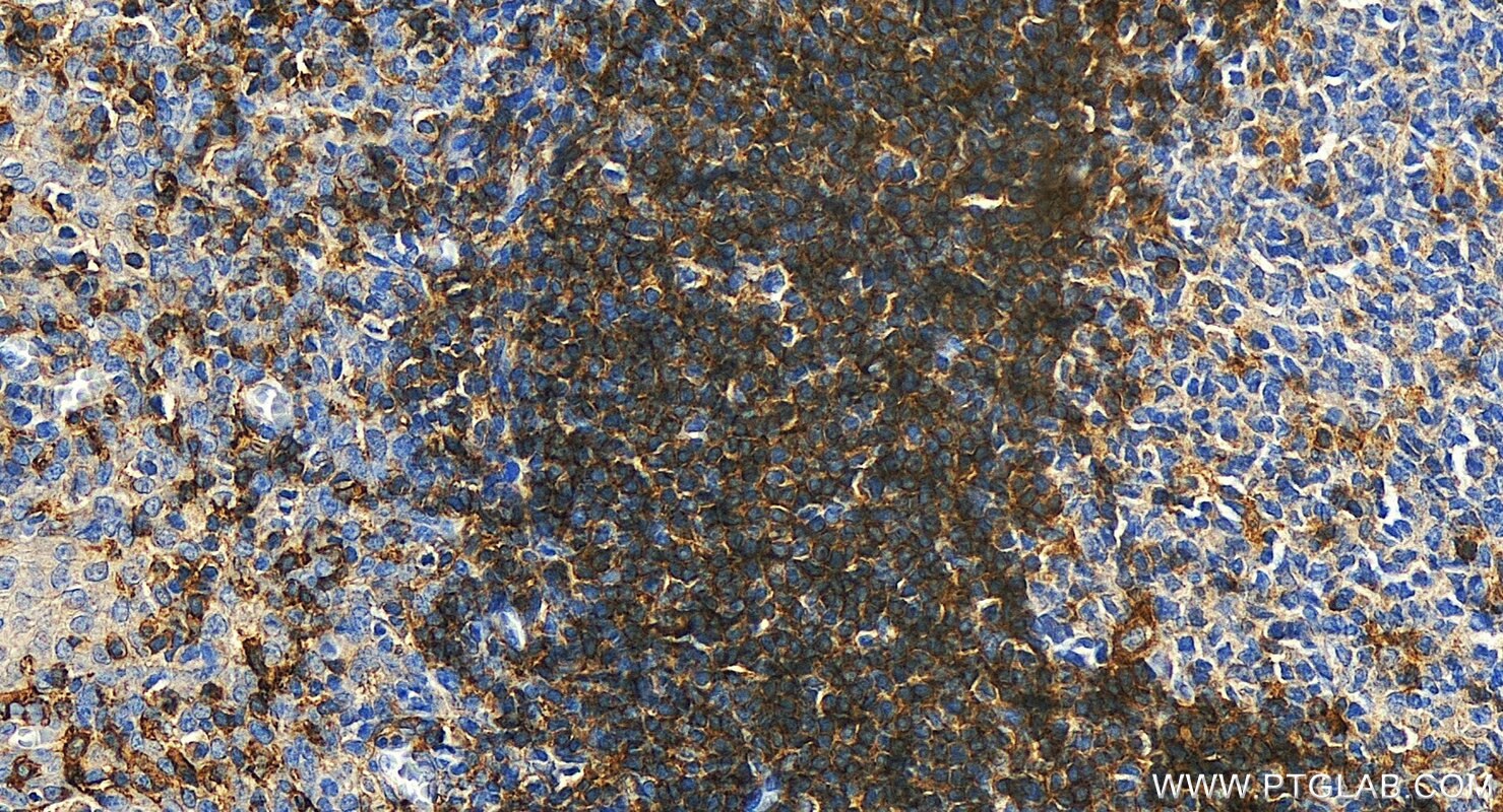 Immunohistochemistry (IHC) staining of human tonsillitis tissue using LAIR1 Recombinant antibody (84677-4-RR)
