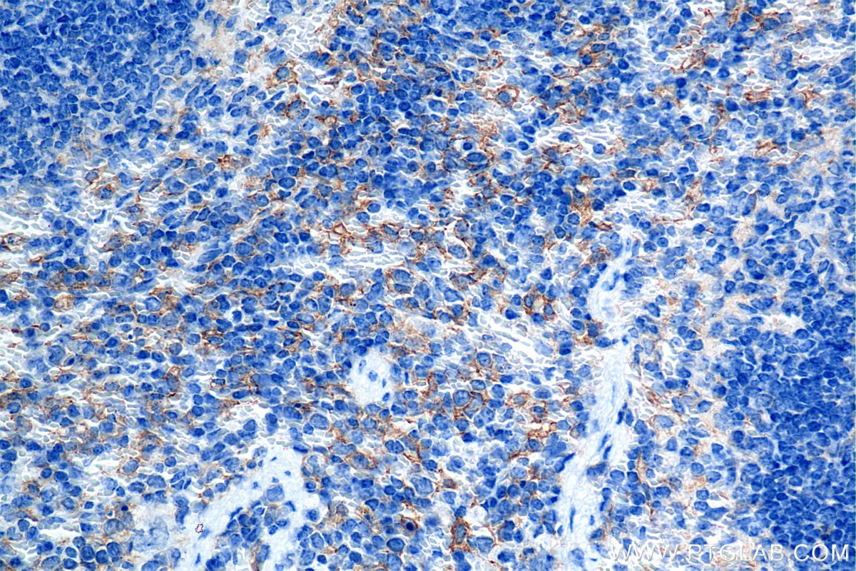 Immunohistochemistry (IHC) staining of mouse spleen tissue using LAIR1 Recombinant monoclonal antibody (85010-1-RR)