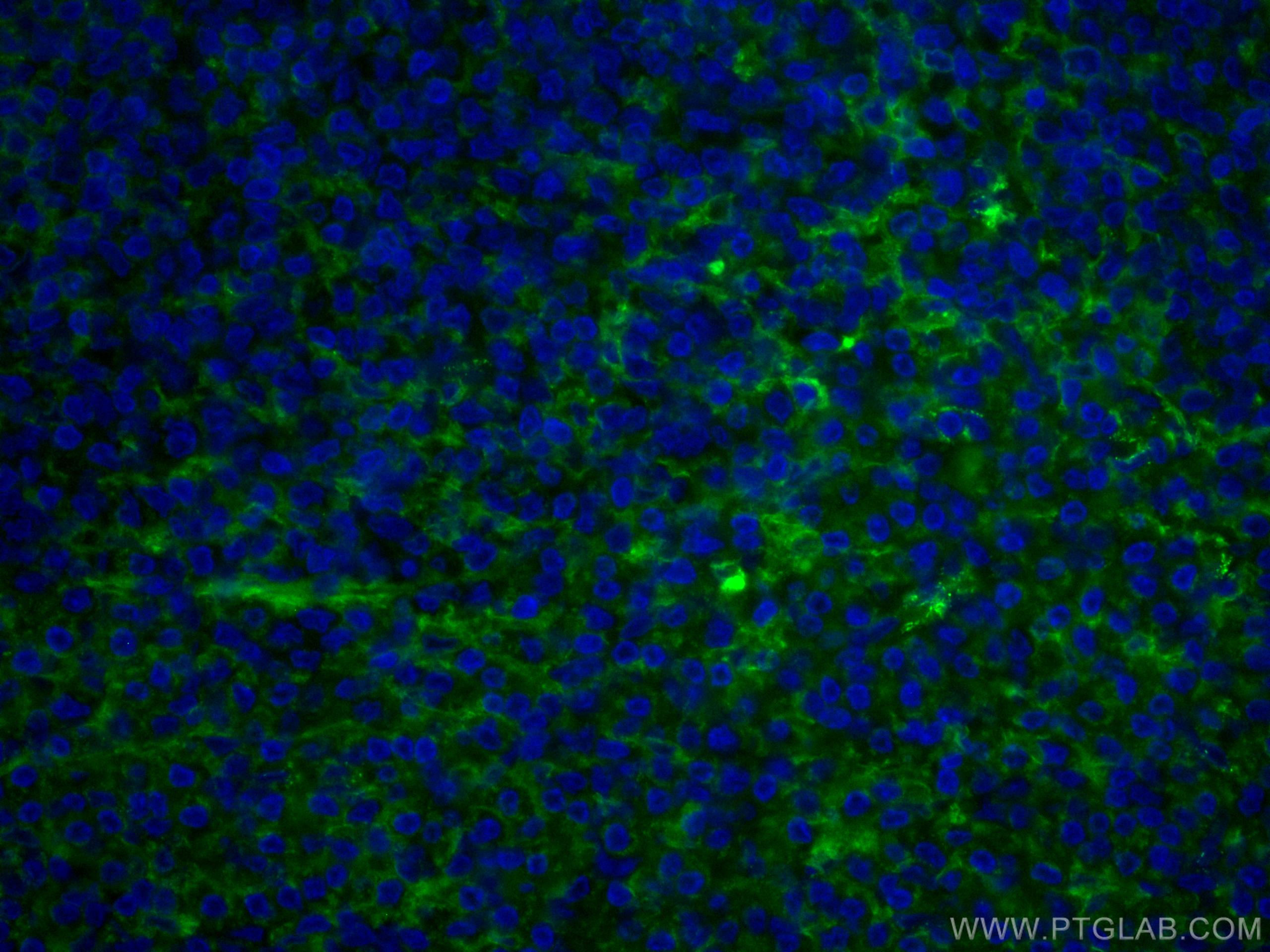 Immunofluorescence (IF) / fluorescent staining of human tonsillitis tissue using CoraLite® Plus 488-conjugated LAIR1 Monoclonal ant (CL488-67220)