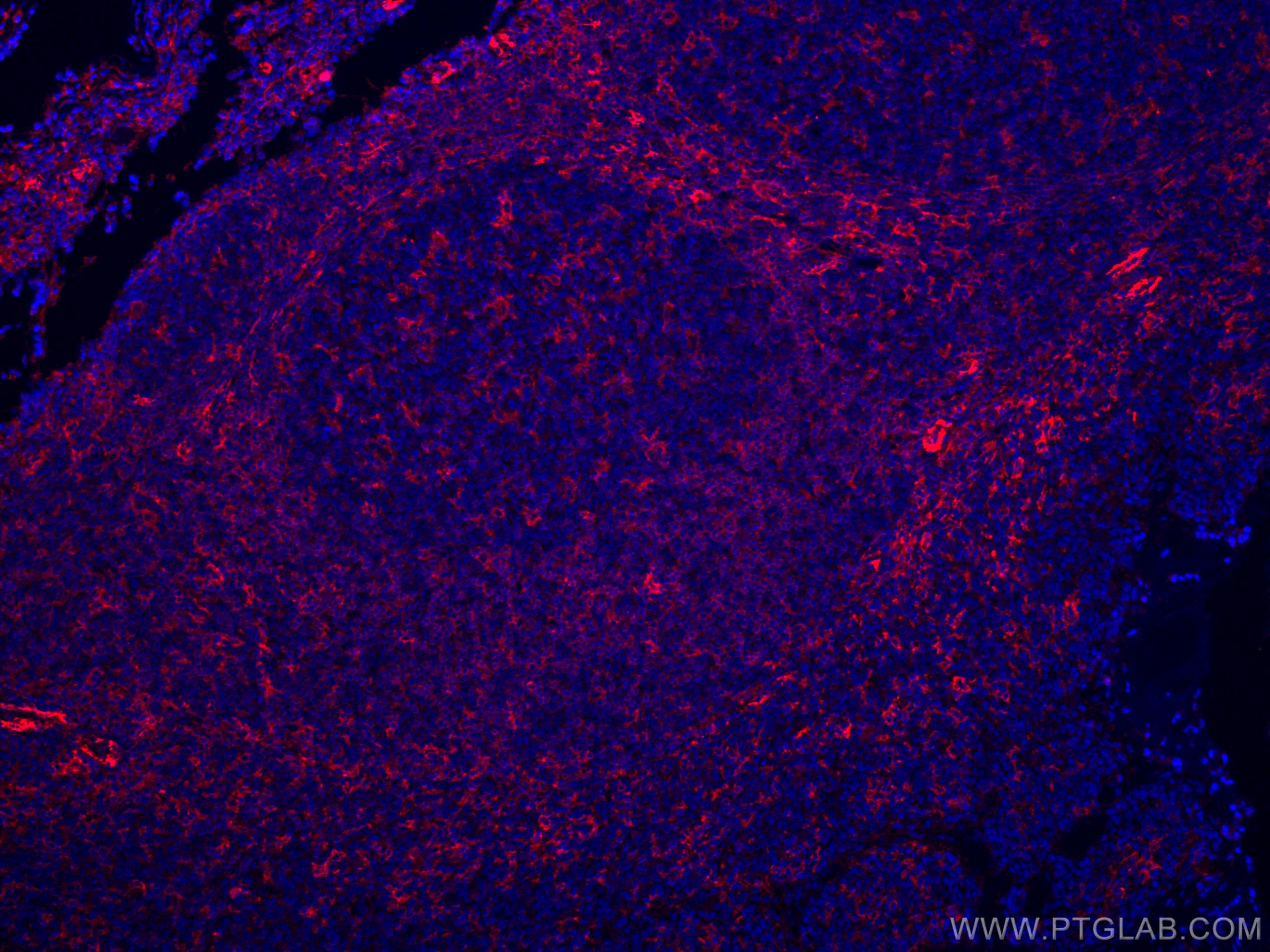 Immunofluorescence (IF) / fluorescent staining of human tonsillitis tissue using CoraLite®594-conjugated LAIR1 Monoclonal antibody (CL594-67220)