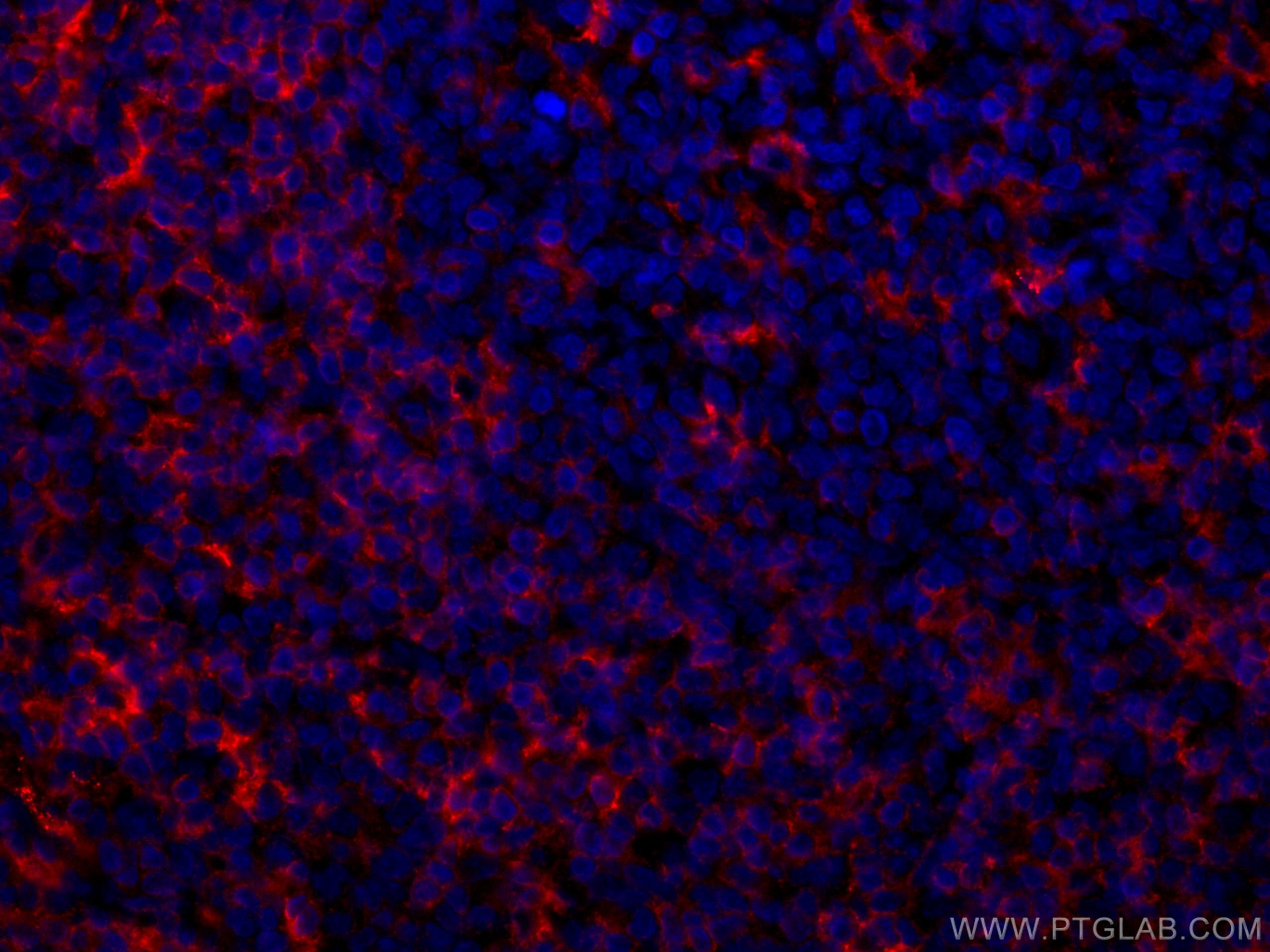 Immunofluorescence (IF) / fluorescent staining of human tonsillitis tissue using CoraLite®594-conjugated LAIR1 Monoclonal antibody (CL594-67220)