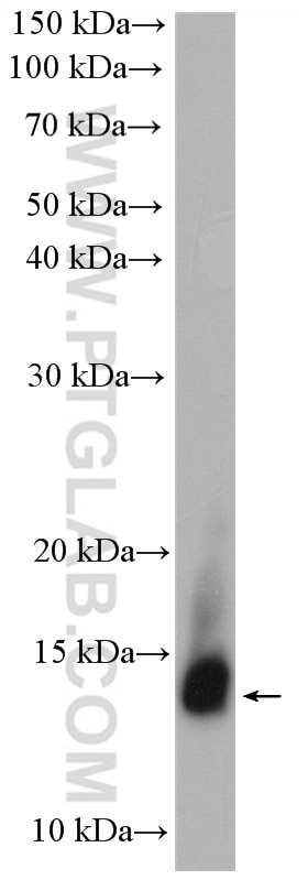 Western Blot (WB) analysis of human saliva using LALBA Polyclonal antibody (24871-1-AP)