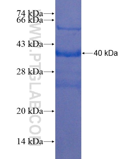 LALBA fusion protein Ag21630 SDS-PAGE