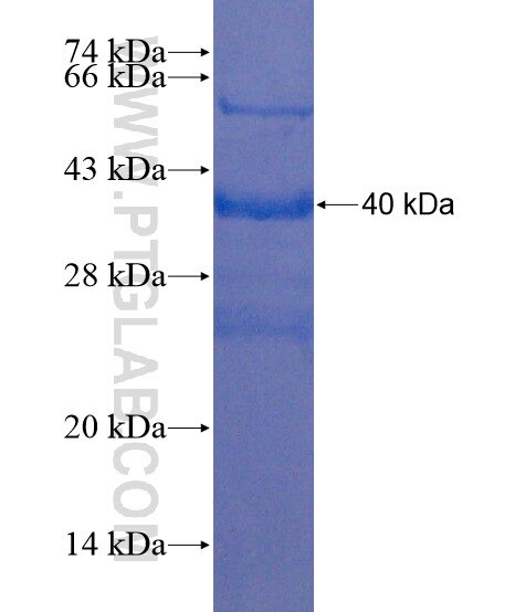 LALBA fusion protein Ag21630 SDS-PAGE