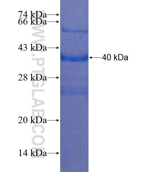 LALBA fusion protein Ag21630 SDS-PAGE