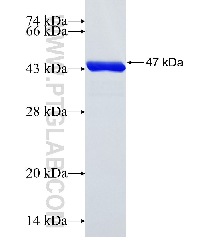 LAMA1 fusion protein Ag29329 SDS-PAGE