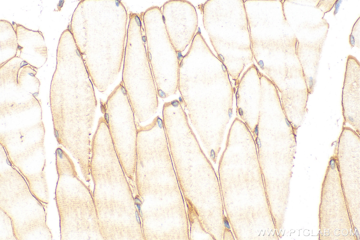 Immunohistochemistry (IHC) staining of mouse skeletal muscle tissue using LAMA2 Polyclonal antibody (31181-1-AP)