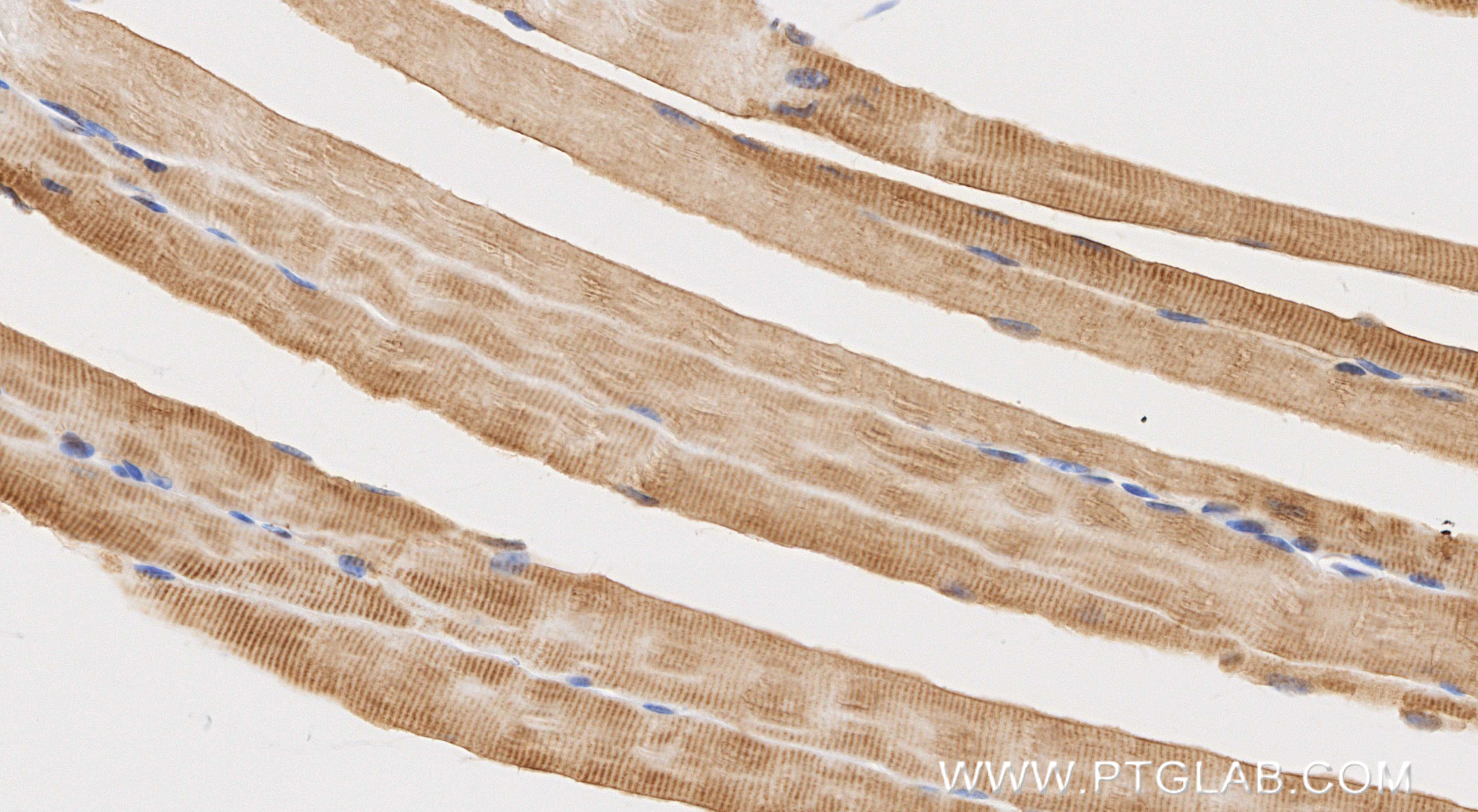 Immunohistochemical analysis of paraffin-embedded mouse skeletal muscle tissue slide using 83007-2-RR (LAMA2 antibody) at dilution of 1:200 (under 40x lens). Heat mediated antigen retrieval with Tris-EDTA buffer (pH 9.0). Immunohistochemistry (IHC) staining of mouse skeletal muscle tissue using LAMA2 Recombinant monoclonal antibody (83007-2-RR)