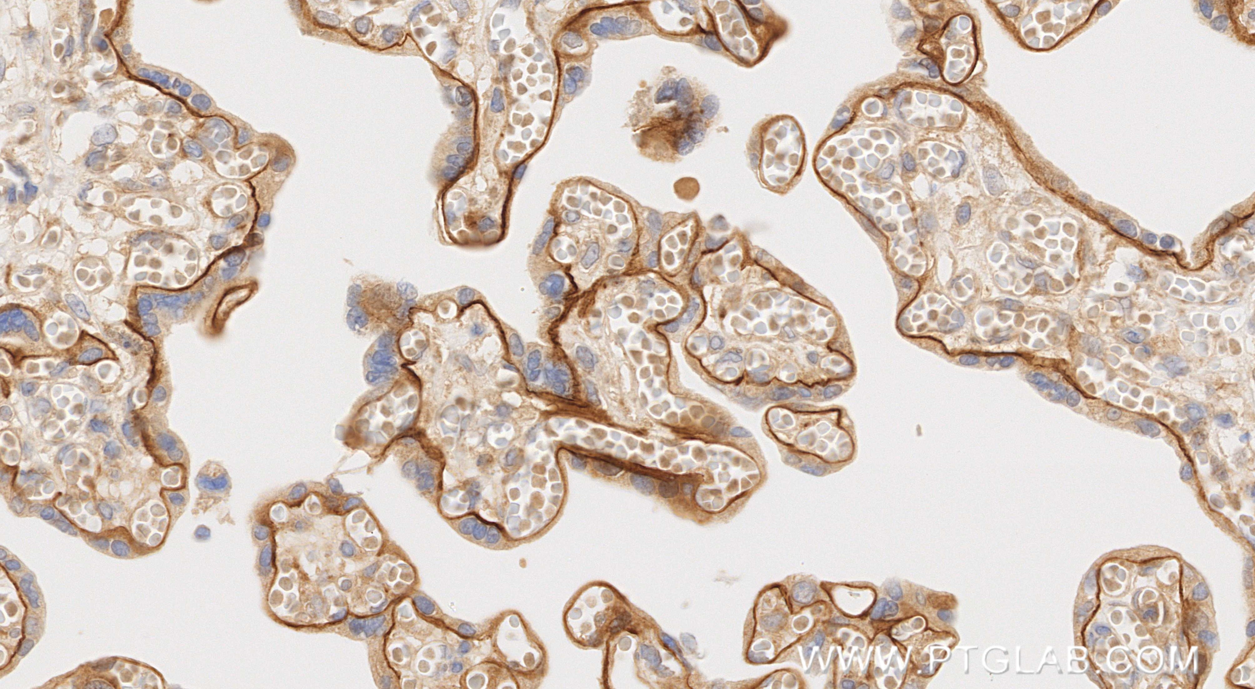 Immunohistochemical analysis of paraffin-embedded human placenta tissue slide using 83007-2-RR (LAMA2 antibody) at dilution of 1:200 (under 40x lens). Heat mediated antigen retrieval with Tris-EDTA buffer (pH 9.0). Immunohistochemistry (IHC) staining of human placenta tissue using LAMA2 Recombinant monoclonal antibody (83007-2-RR)