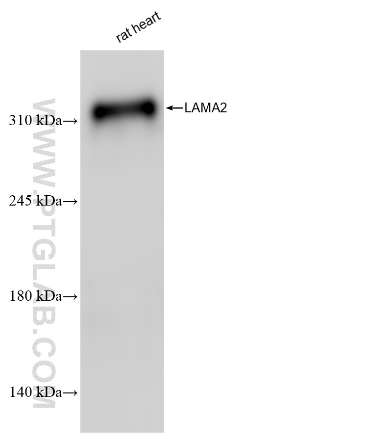 Western Blot (WB) analysis of various lysates using LAMA2 Recombinant antibody (83007-2-RR)