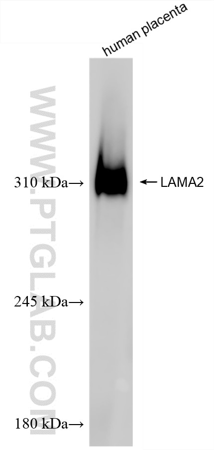 Western Blot (WB) analysis of human placenta tissue using LAMA2 Recombinant antibody (83007-2-RR)