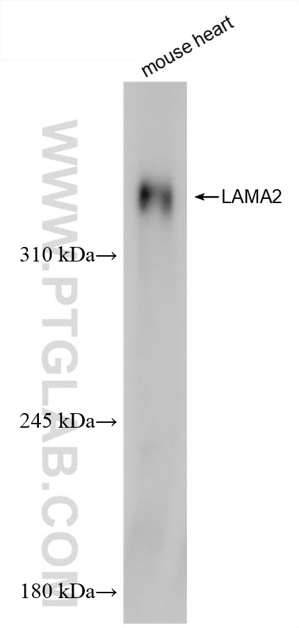 Western Blot (WB) analysis of mouse heart tissue using LAMA2 Recombinant antibody (83007-2-RR)