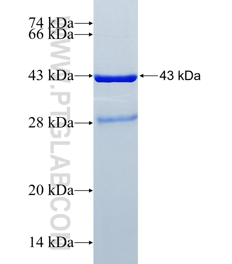 LAMA2 fusion protein Ag34494 SDS-PAGE