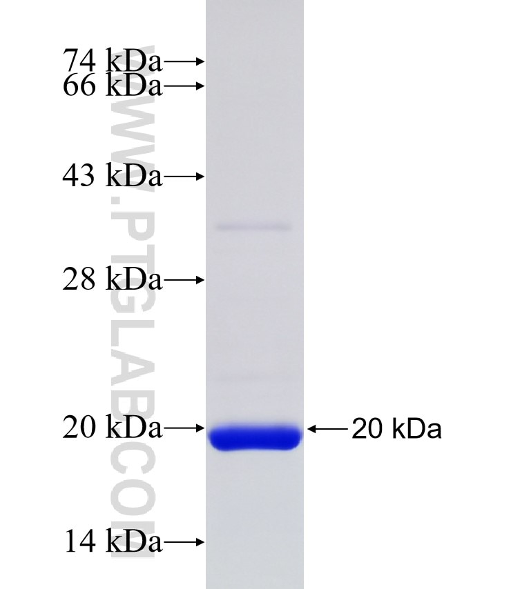 LAMA2 fusion protein Ag34528 SDS-PAGE LAMA2 fusion protein Ag34528 SDS-PAGE