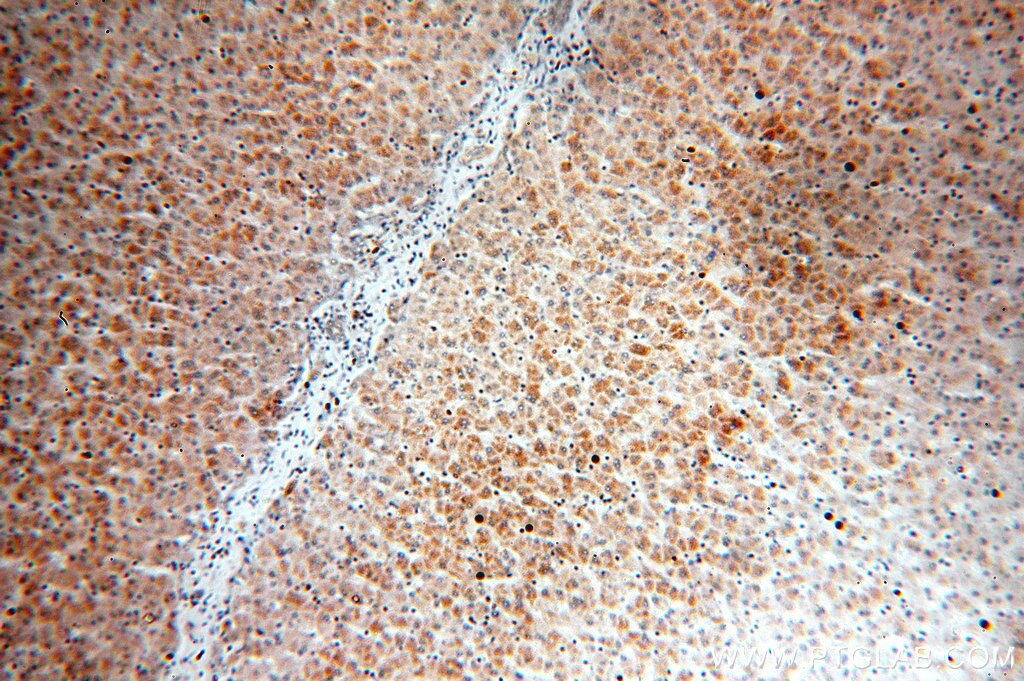 LAMA4 (Isoform 3)