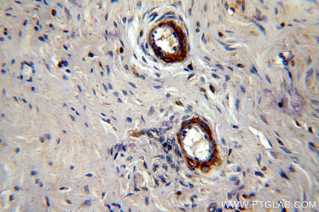 Immunohistochemistry (IHC) staining of human ovary tissue using LAMA4 (Isoform 3) Polyclonal antibody (10465-1-AP)