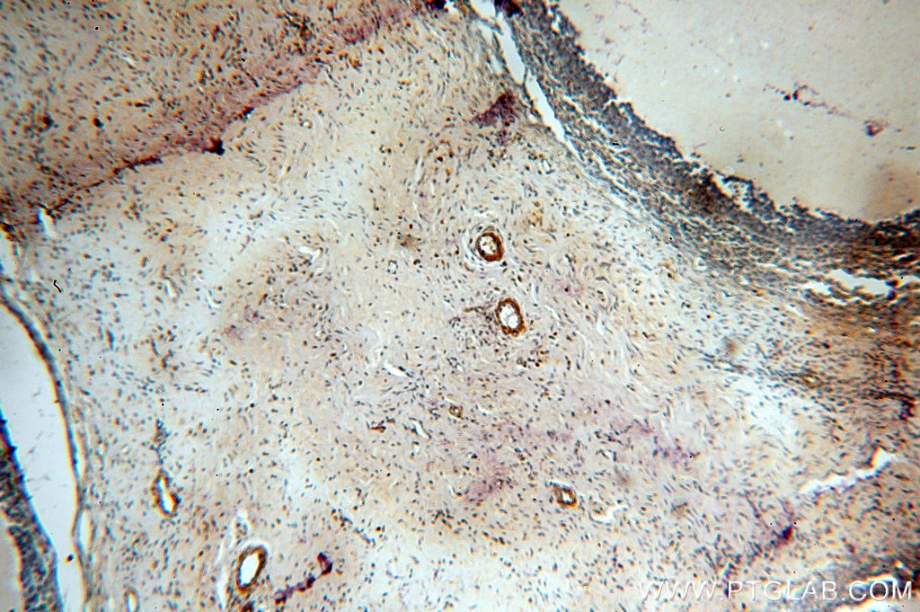 Immunohistochemistry (IHC) staining of human ovary tissue using LAMA4 (Isoform 3) Polyclonal antibody (10465-1-AP)