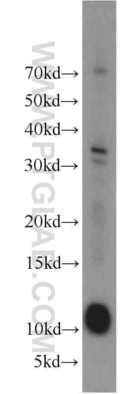 Western Blot (WB) analysis of human heart tissue using LAMA4 (Isoform 3) Polyclonal antibody (10465-1-AP)