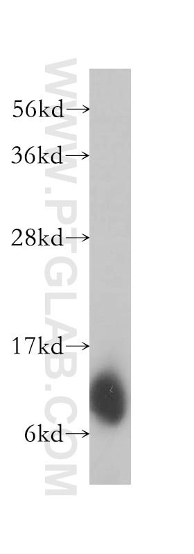 Western Blot (WB) analysis of human skeletal muscle tissue using LAMA4 (Isoform 3) Polyclonal antibody (10465-1-AP)