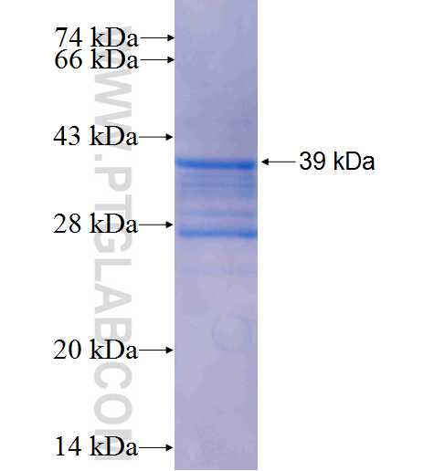 LAMA4 fusion protein Ag0736 SDS-PAGE