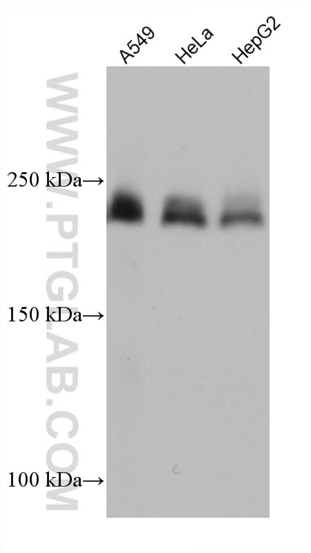 Laminin beta 1