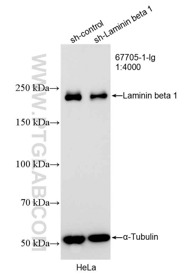 WB result of Laminin beta 1 antibody (67705-1-Ig; 1:4000; incubated at room temperature for 1.5 hours) with sh-Control and sh-Laminin beta 1 transfected HeLa cells. Western Blot (WB) analysis of HeLa cells using Laminin beta 1 Monoclonal antibody (67705-1-Ig)