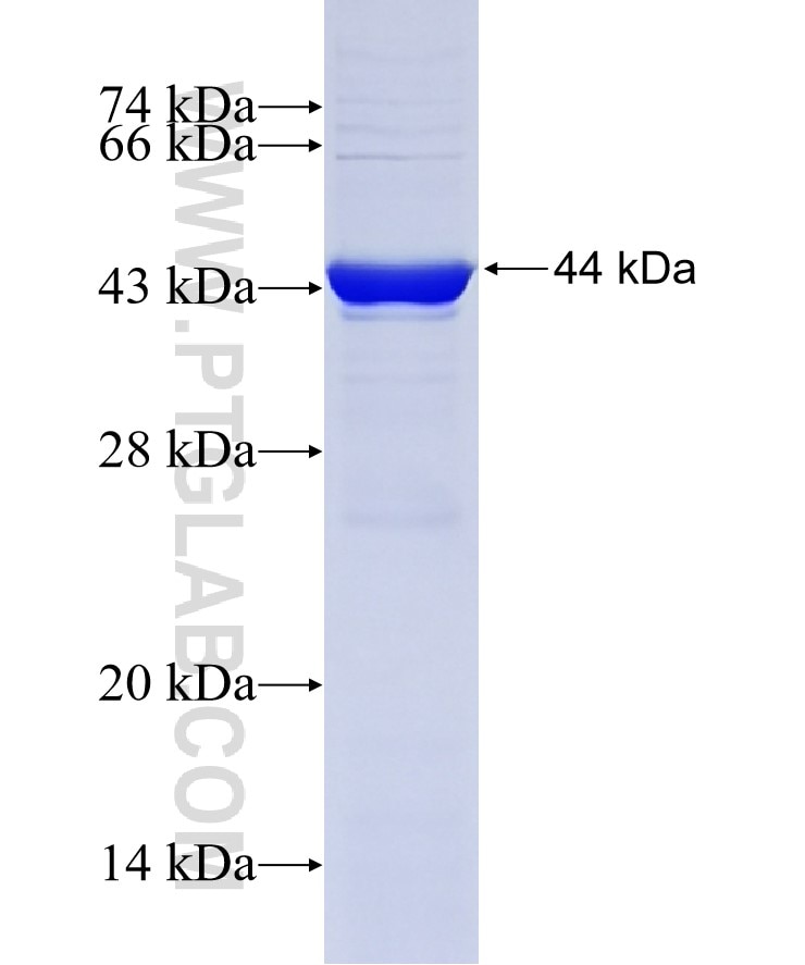 LAMB1 fusion protein Ag19182 SDS-PAGE