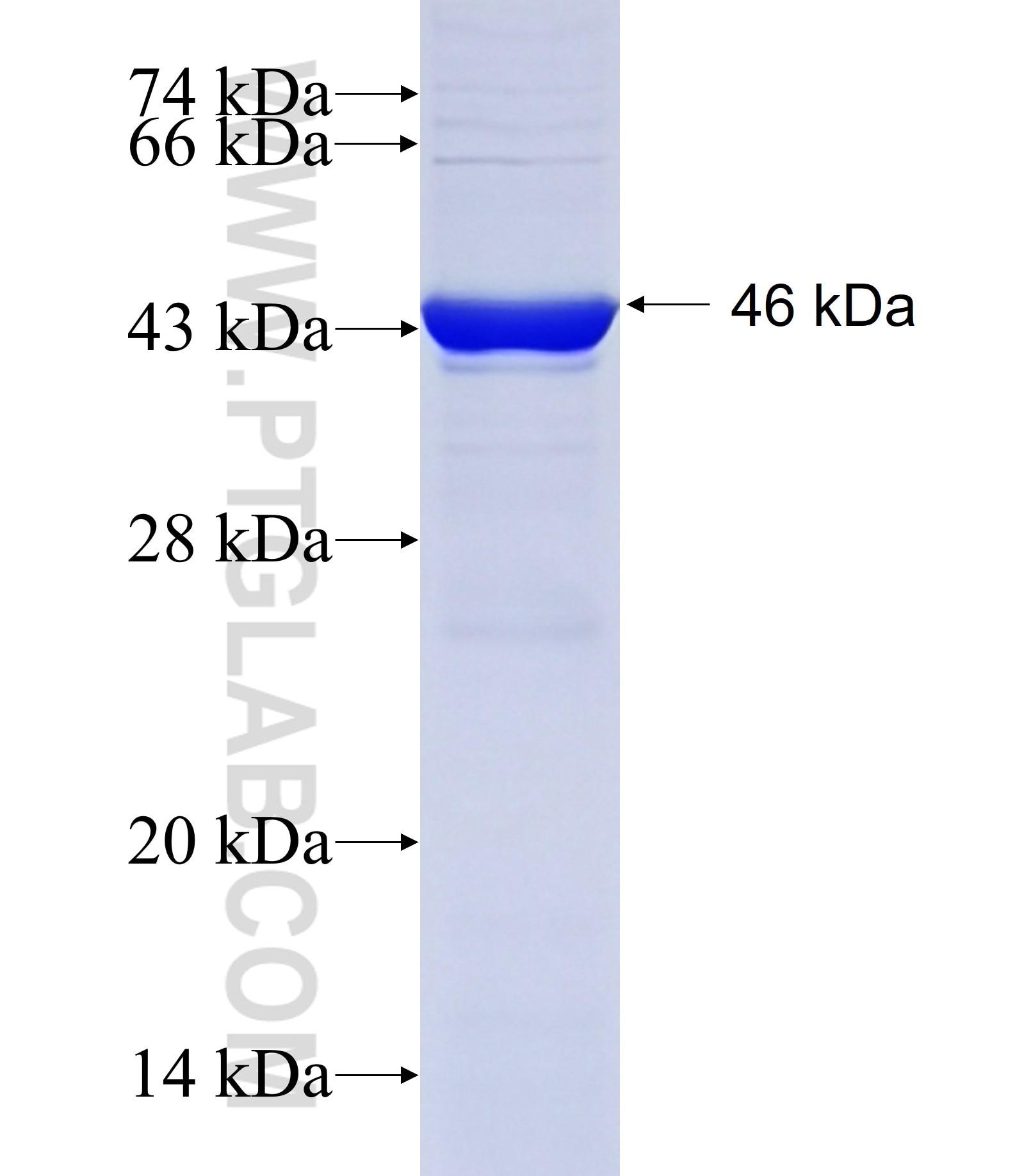 LAMB1 fusion protein Ag19182 SDS-PAGE