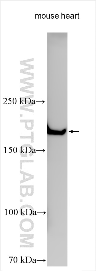 Western Blot (WB) analysis of various lysates using LAMB2 Polyclonal antibody (30943-1-AP)