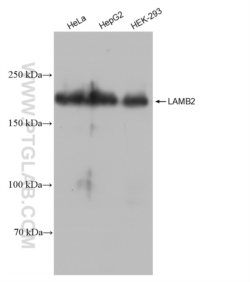 Western Blot (WB) analysis of various lysates using LAMB2 Recombinant antibody (82946-1-RR)