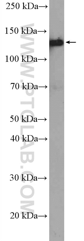 Western Blot (WB) analysis of A431 cells using LAMB3 Polyclonal antibody (26795-1-AP)