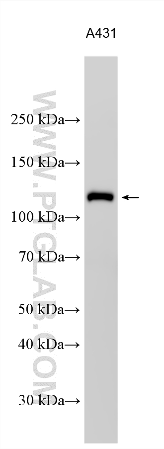 WB analysis using 26795-1-AP Western Blot (WB) analysis of various lysates using LAMB3 Polyclonal antibody (26795-1-AP)