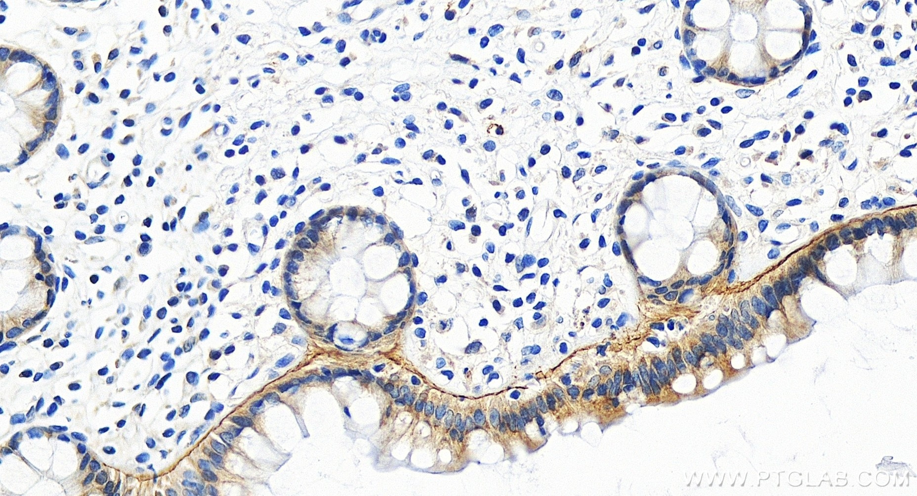 Immunohistochemistry (IHC) staining of human colon tissue using LAMB3 Recombinant antibody (85055-4-RR)