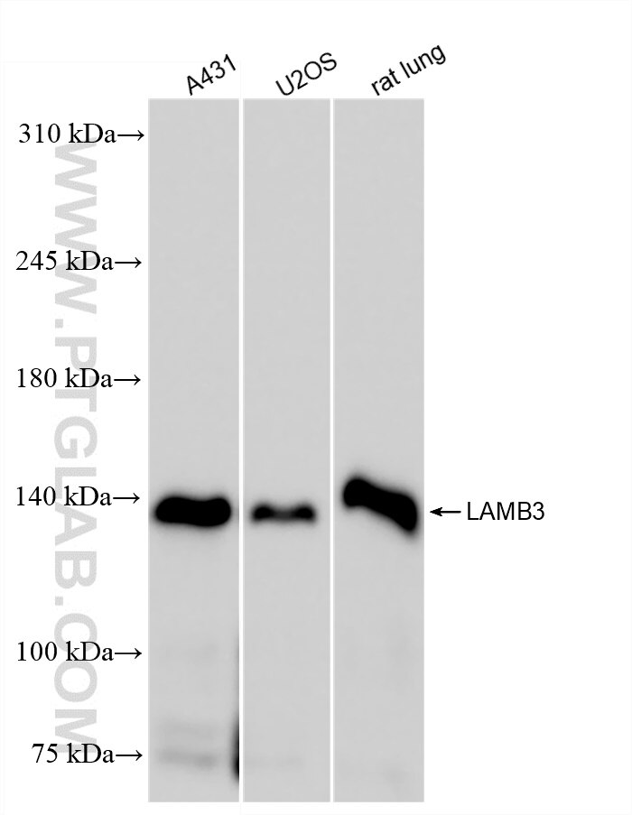 Western Blot (WB) analysis of various lysates using LAMB3 Recombinant antibody (85055-4-RR)