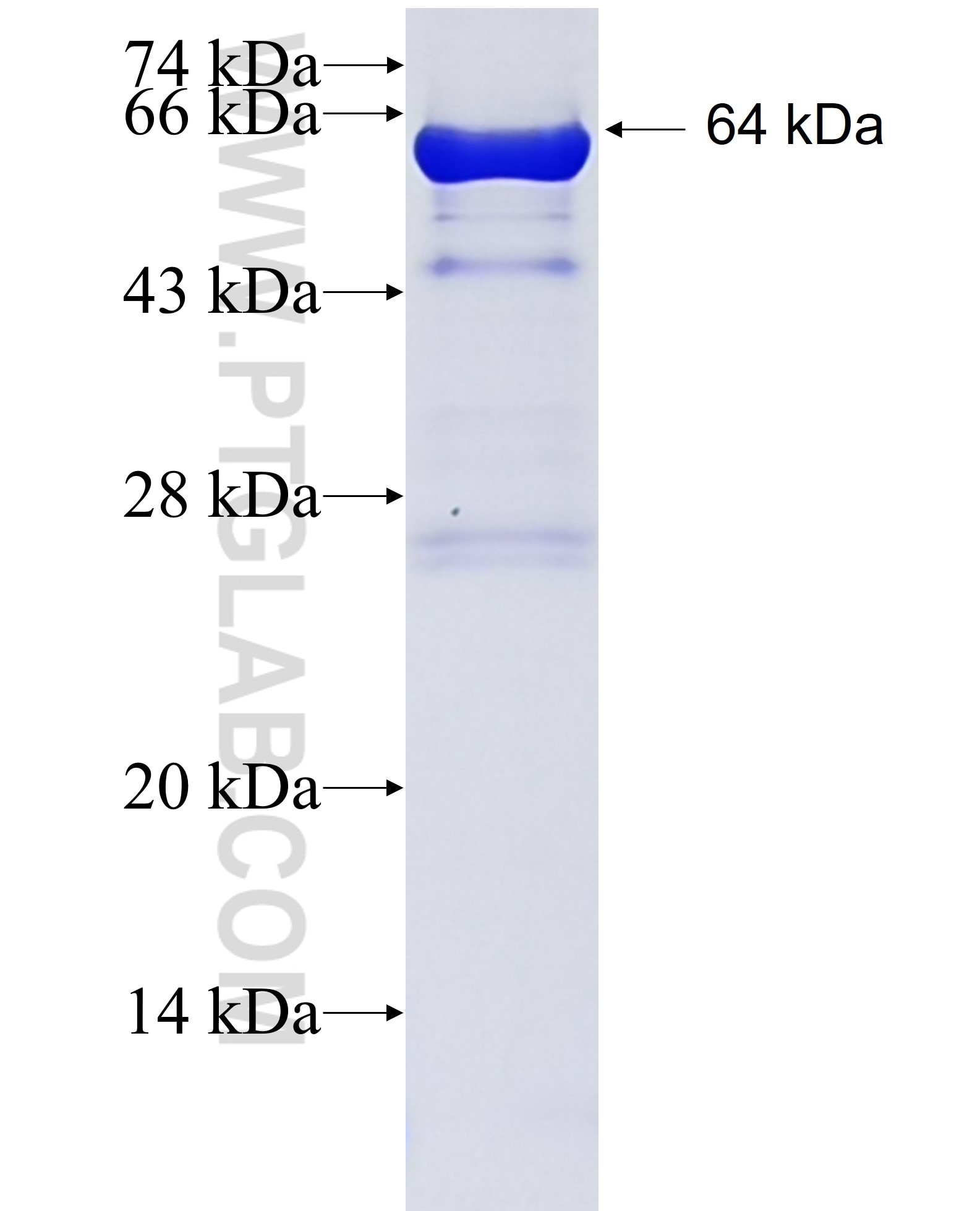 LAMB3 fusion protein Ag25192 SDS-PAGE