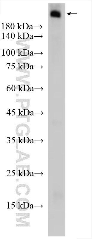 Western Blot (WB) analysis of mouse skin tissue using LAMB4 Polyclonal antibody (25217-1-AP)