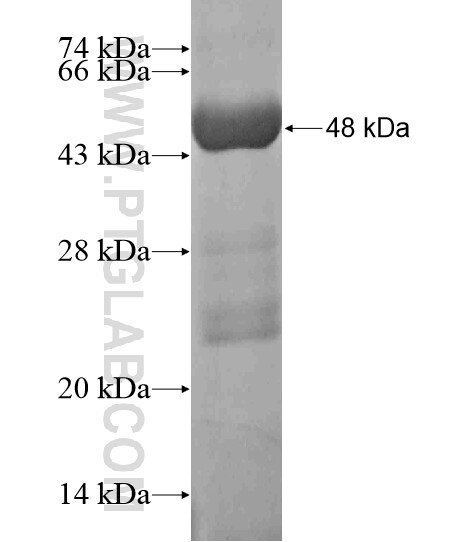 LAMB4 fusion protein Ag19401 SDS-PAGE