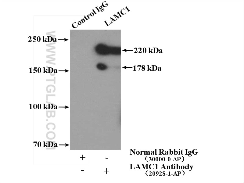 Immunoprecipitation (IP) experiment of DU 145 cells using LAMC1 Polyclonal antibody (20928-1-AP)