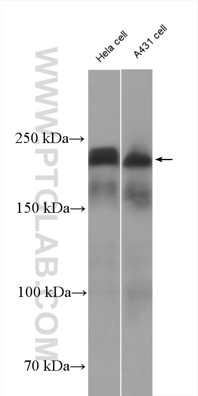 Western Blot (WB) analysis of HeLa cells using LAMC1 Polyclonal antibody (20928-1-AP)