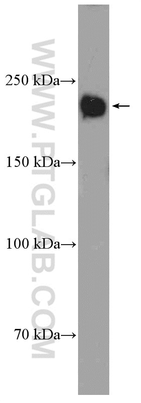 Western Blot (WB) analysis of DU 145 cells using LAMC1 Polyclonal antibody (20928-1-AP)